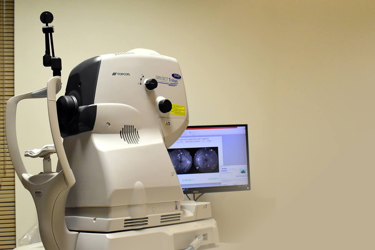 topcon-drioct-triton2-centro-oftalmologico-noreste-reynosa
